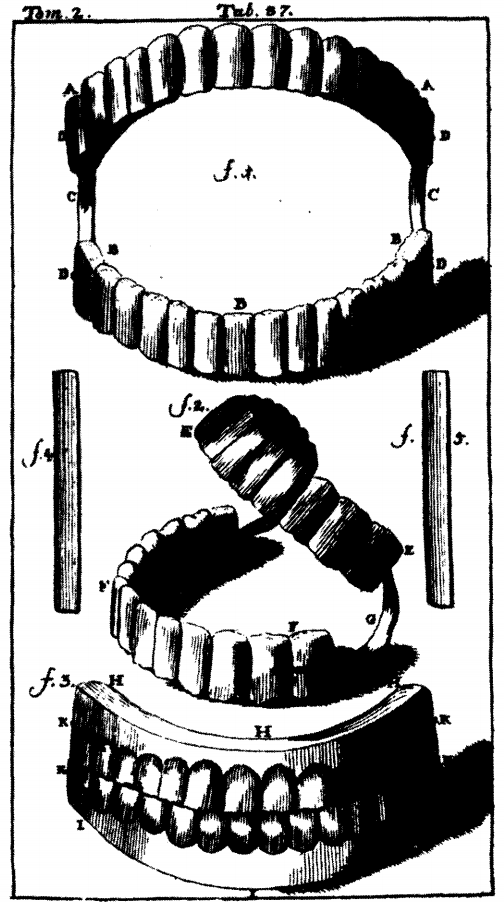 Pierre_Fauchard_-_Le_Chirurgien_Dentiste_-_dentures